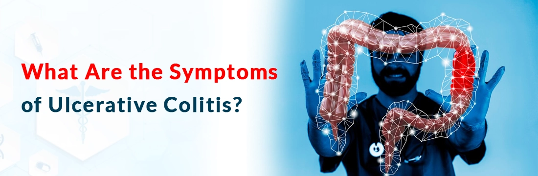  What Are the Symptoms of Ulcerative Colitis?